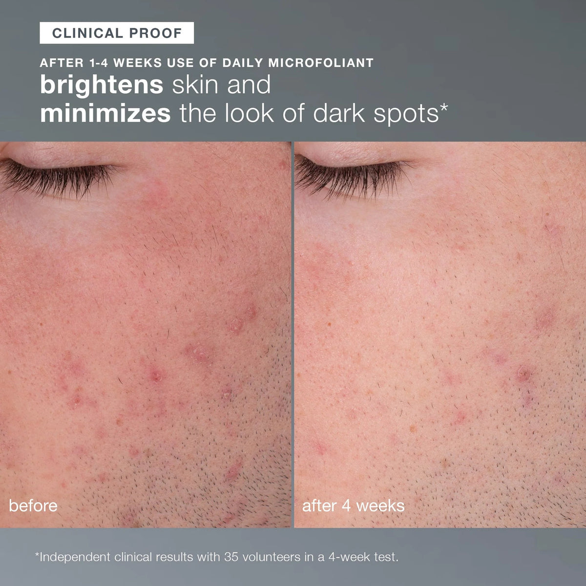 [EXP. 11/26] skin transformation duo kit