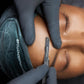 pro dermaplanning