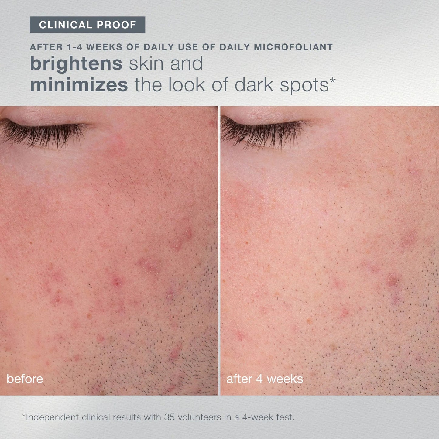 [Limited Stocks] first snow of the season bundle (seasonal edition canister + refill)